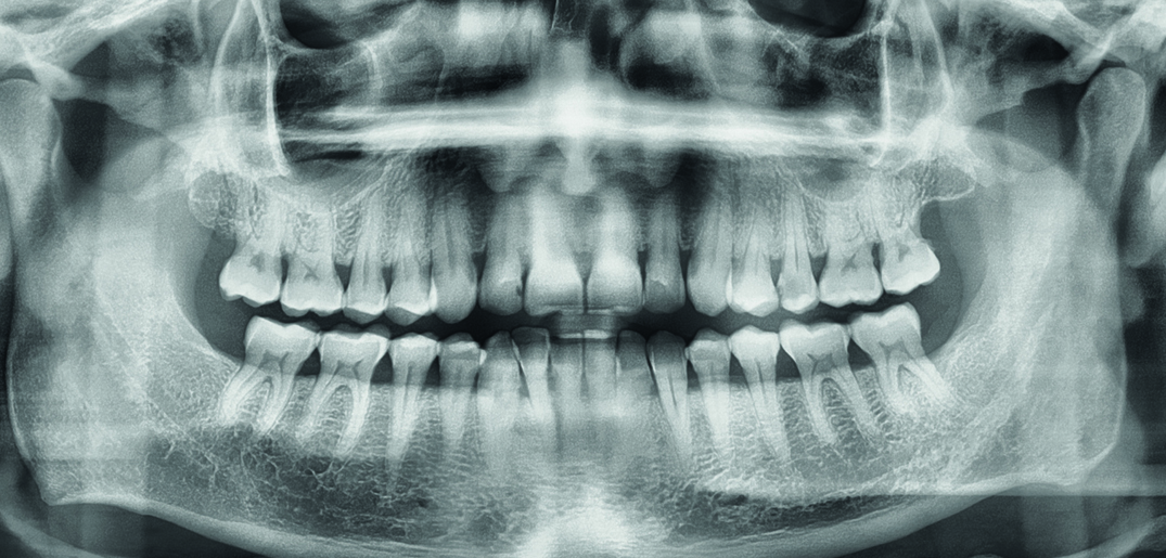 Teeth_xray.jpg