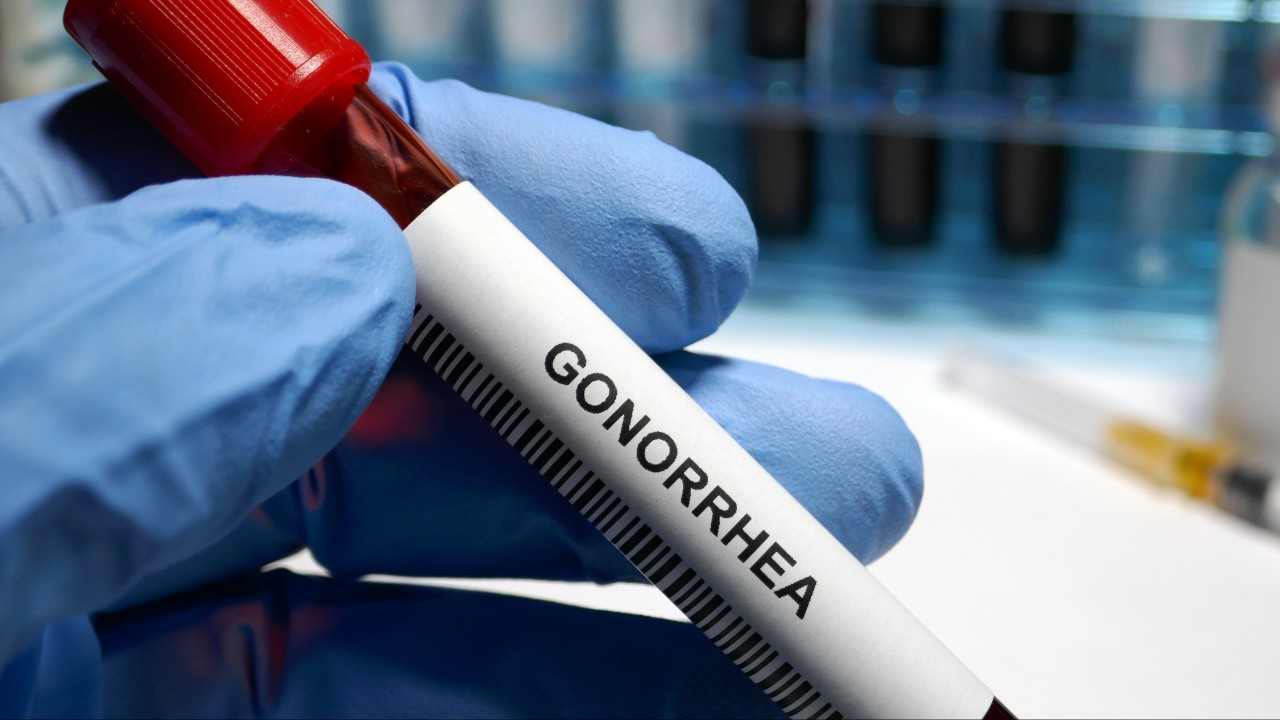 gonorrhoea-cases-surge-1280